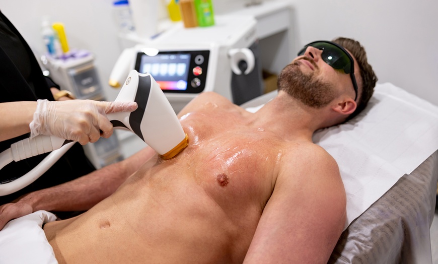 Image 2: Up to 87% Off: 3 Sessions of Laser Hair Removal w/Complementary Top-Up