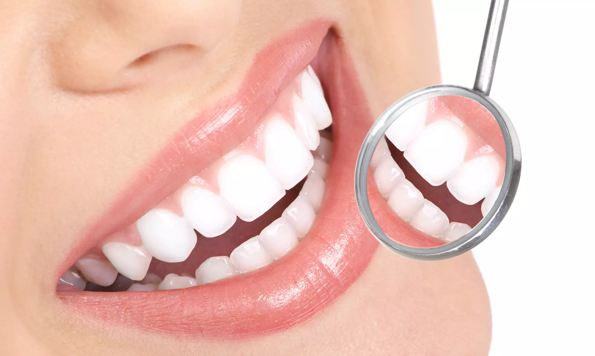 $69 for Dental Exam, Regular Cleaning, Full X-Rays, and Oral-Cancer Screen at Safe Dental Group ($499) - Primary Image