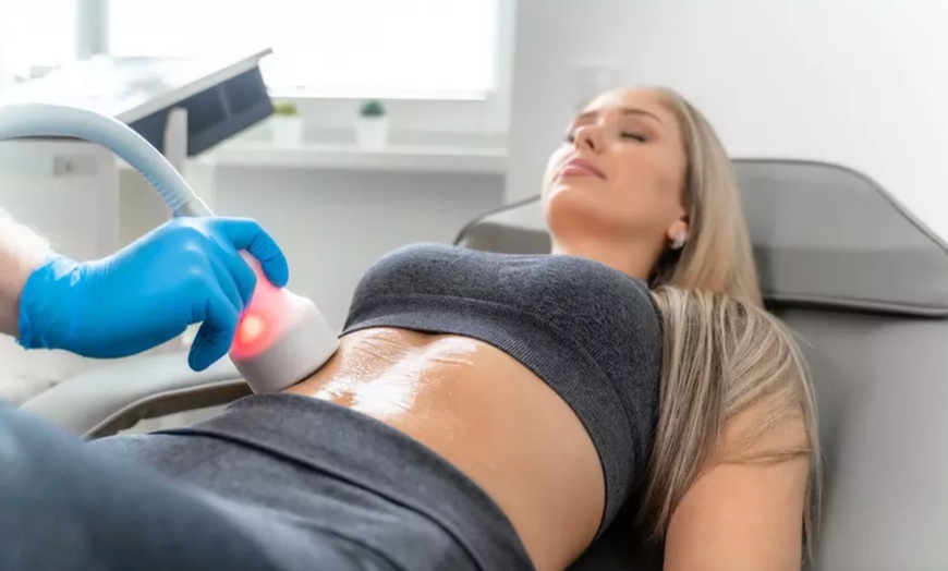 Image 1: 30 Min. CryoShaper Anwendung an 1x Zone für 1 Person