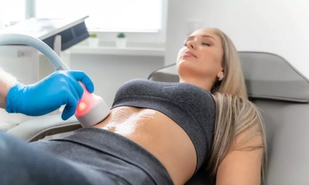 30 Min. CryoShaper Anwendung an 1x Zone für 1 Person - Cryopoint Winterhude