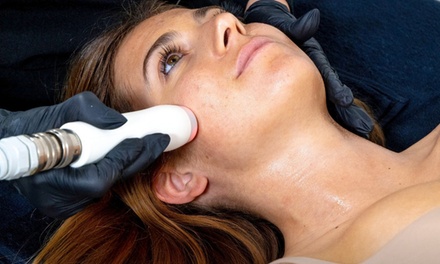 Face Toning and Sculpting session on Non Invasive TShape 2 with Red Light and Organic Hyaluronic Acid treatment - Red Hot Fusion