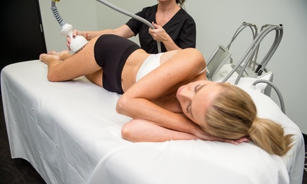 1 Venus Session (large area, 30 minutes)  - Revita Cute Home Spa