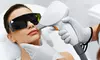 Experience Flawless Skin with Six Sessions of Laser Hair Removal in Small, Large, or Medium (Up to 86% Off)