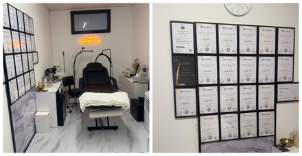 0.5 ML Dermal Filler with Consultation - Embraces Beauty Lounge