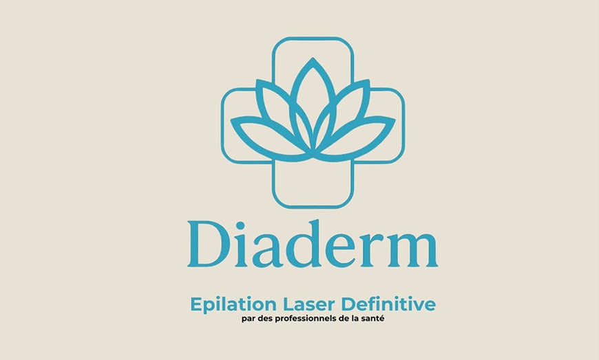Image 5: Épilation laser durable sur petites, moyennes et grandes zones