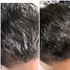 Image 3: Dermclar Method Hair Loss prevention and Neck Massage