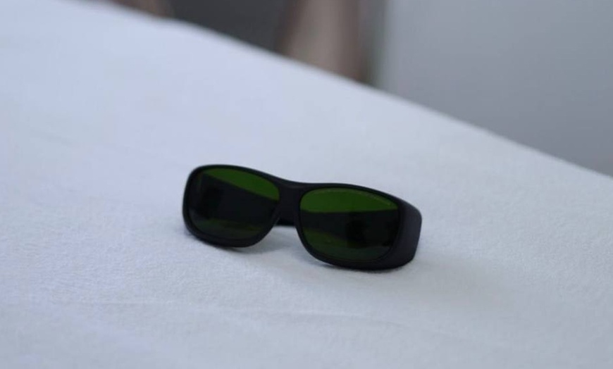 Image 3: Do 0% zniżki na Depilacja laserowa w Glow Epil