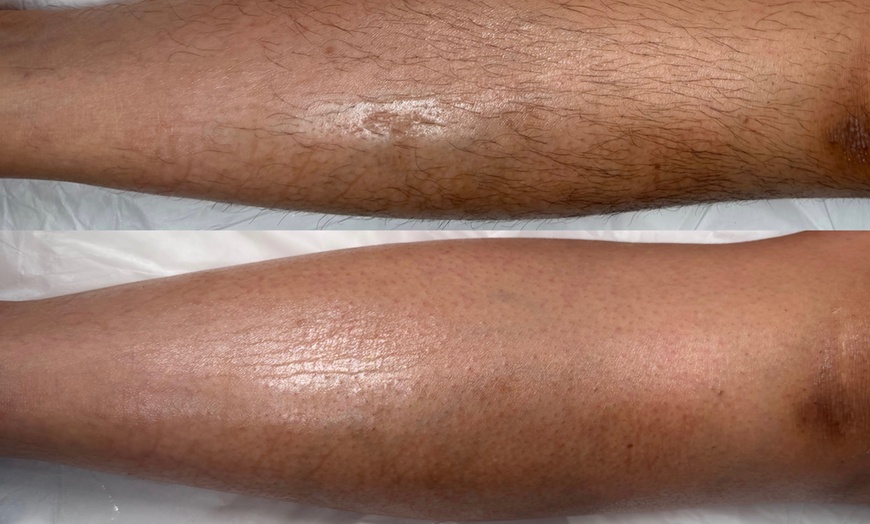 Image 3: Get a Full Body Wax or Underarms, Lower Legs and Brazilian Wax