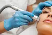 Glow with 30 Min Express Microdermabrasion, LED-45 Min, Lactic, Pigmentation or Salicylic A Peel (Up to 55%Off) - Image 2