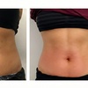 Image 1: One or Three Fat Reduction Treatments with Venus Bliss Max