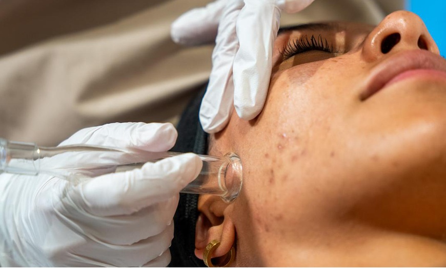 Image 4: Up to 47% Off on Facial - HydraFacial at Empress Skin Bromsgrove