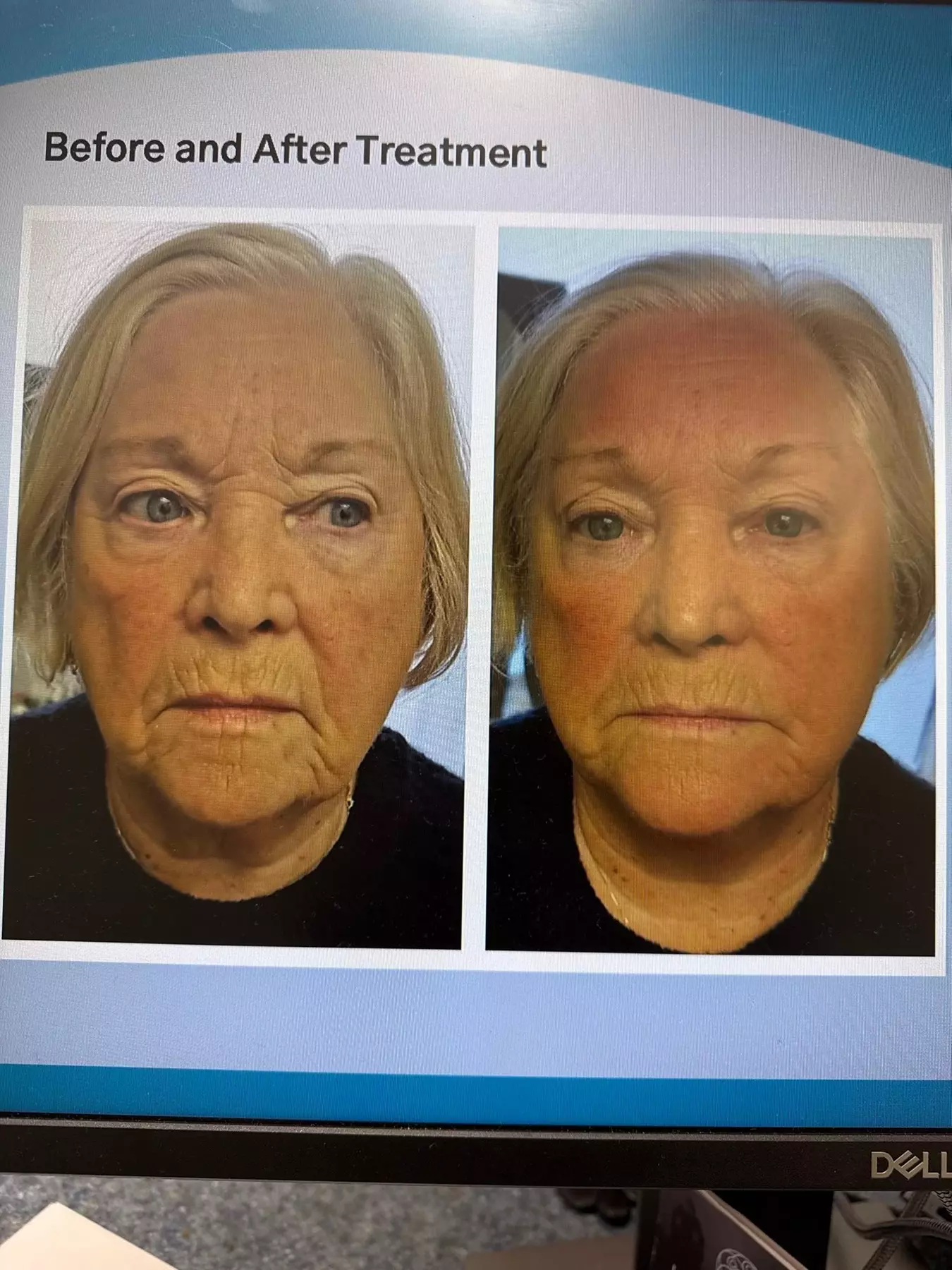 30-Minute T-Shape 2'' Massage w/ Optional Styku 3D Body Scan for 1 at Lifestyle Health Solutions (Up to 64% Off)