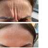 Image 3: Up to 47% Off Botox and Juvéderm at AK Medical Spa