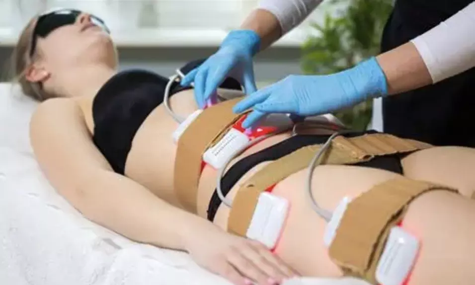 Three, Six, Nine, or Twelve Snella Non-Invasive Laser Lipo Sessions