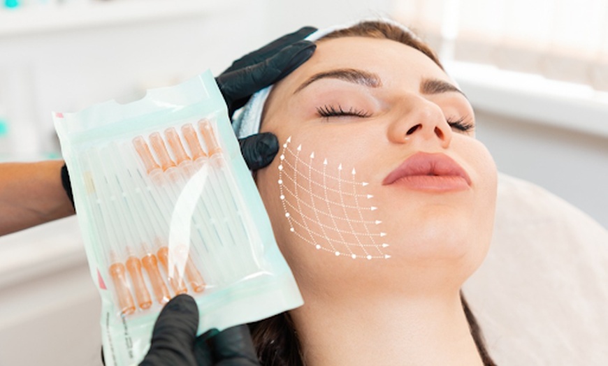 Image 1: PDO Thread Lift for Face, Neck, Eyes or Lips