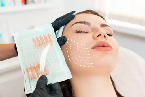 PDO Thread Lift for Face, Neck, Eyes or Lips