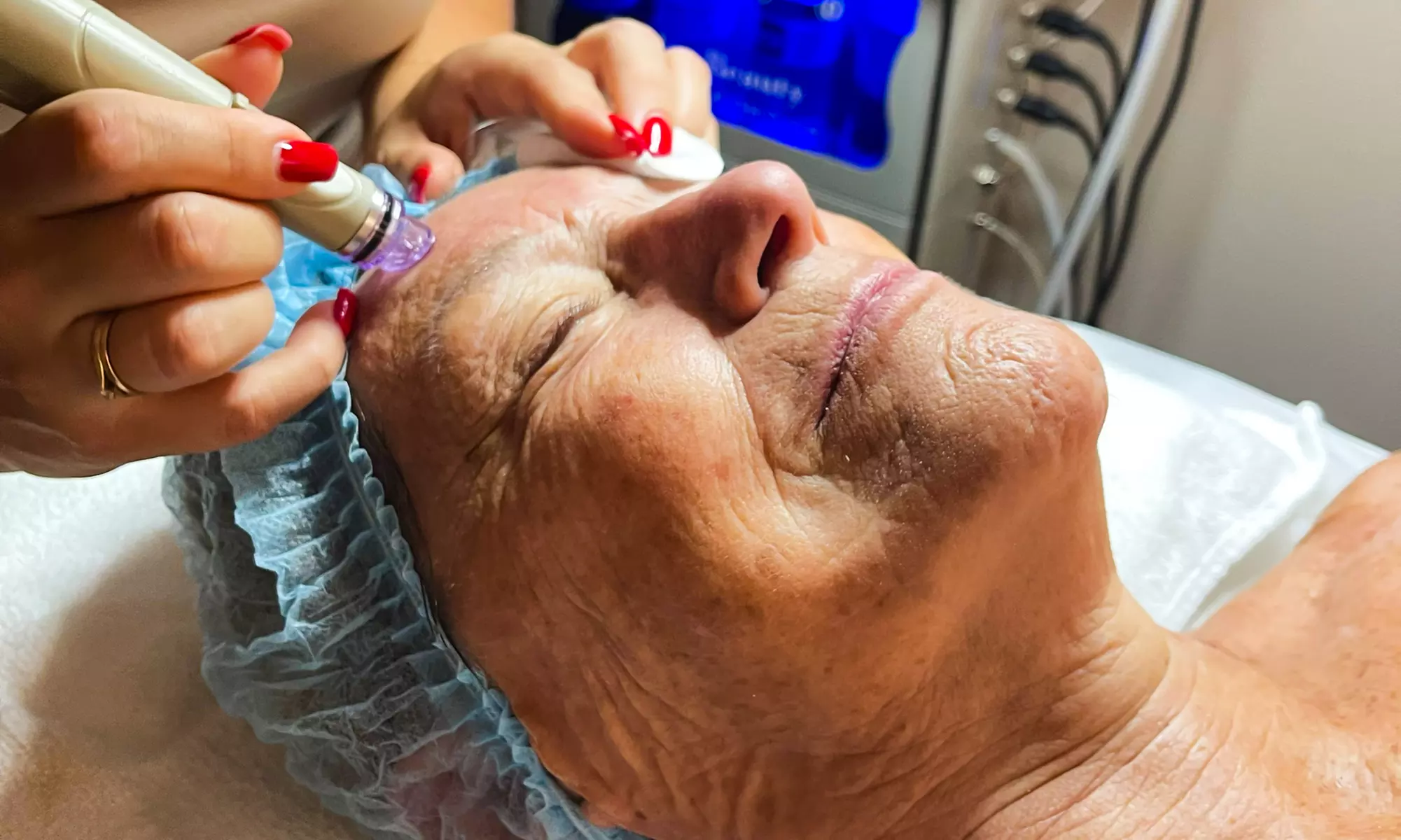 Refresh with One, Two, Three 60-Minute HydraFacial