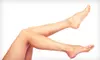 Two or Four Laser Spider-Vein Treatments at Changes Medical & Wellness Spa (84% Off)
