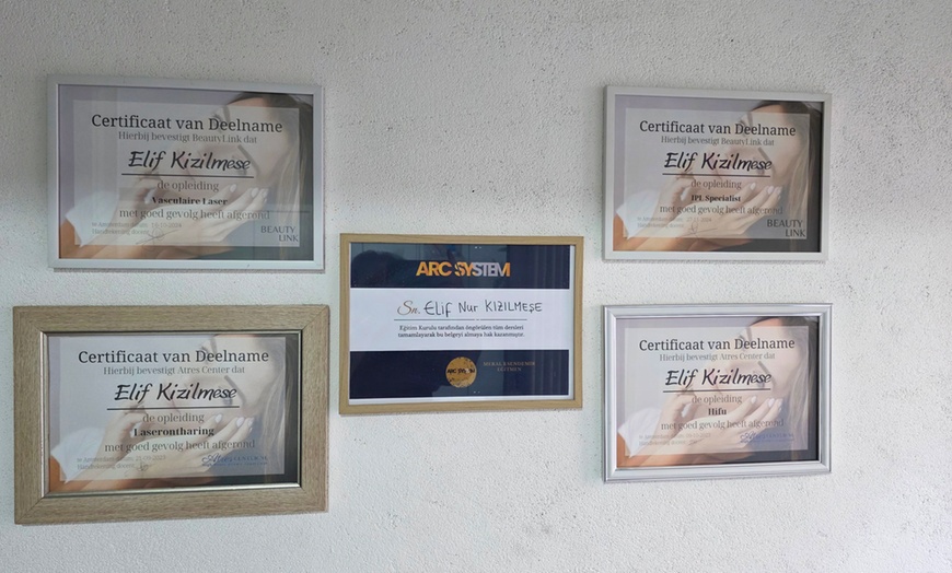 Image 3: Stralende en verjongde huid met professionele HIFU behandelingen