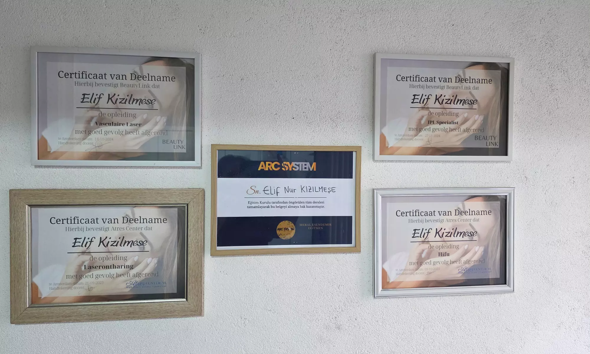 Stralende en verjongde huid met professionele HIFU behandelingen