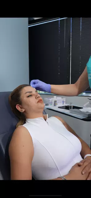 Enhance Your Beauty with 20, 40 or 60 Units of Botox