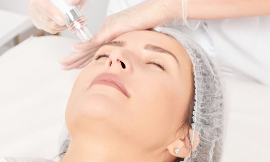 Image 1: Aqua-Facial inkl. JetPeeling für 1 Person: Für ein frisches Hautbild 