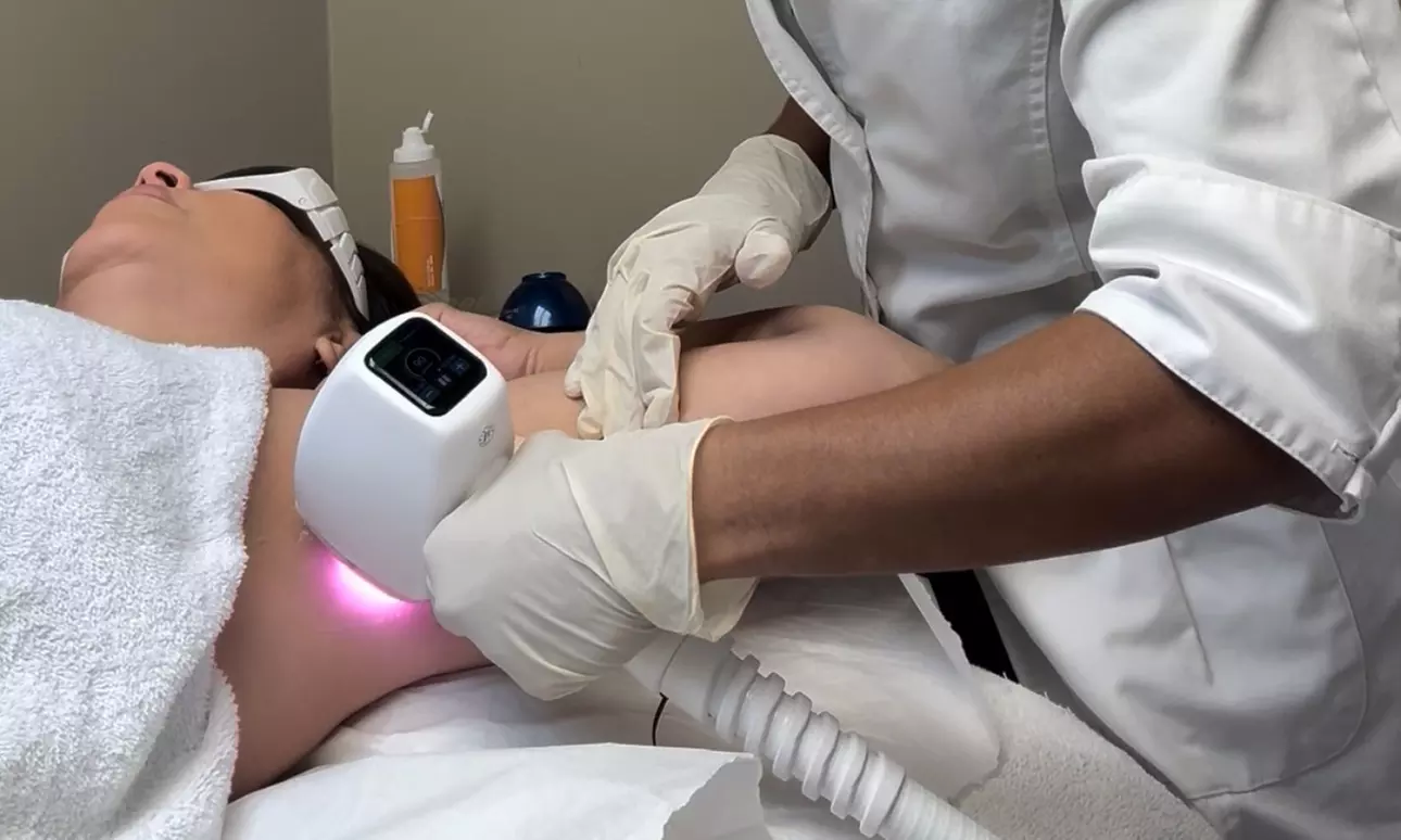 Laser Hair Removal – Three Small Areas or Mixed Area Package at L'Baton Skin Care (Up to 55% Off) - Primary Image