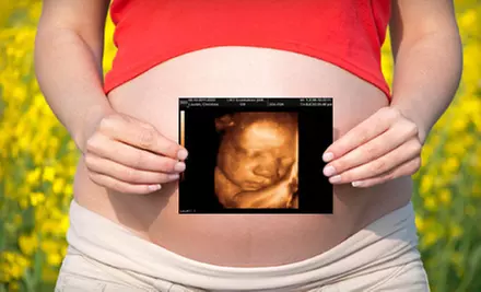 $39 for a Prenatal Ultrasound with Prints and CD at A New Image Baby ($79.99 Value) - Primary Image