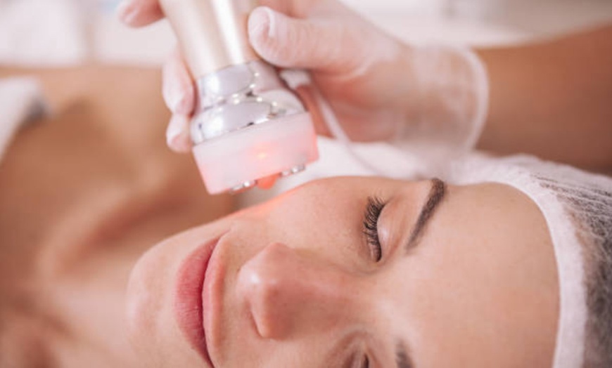 Image 13: Radiofrecuencia facial con bomba de hidratación o velo de colágeno