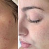 Image 2: Up to 55% Off on Facial - Chosen by Customer at Rise Skin Spa