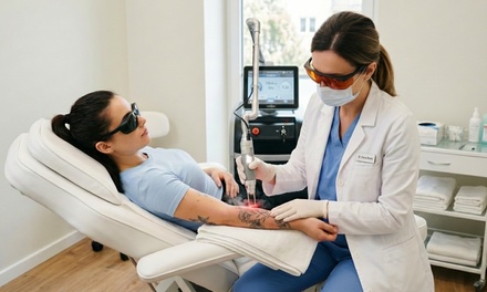 Three Laser Tattoo Removal Sessions on a Small Area 2x2 - Skinsations