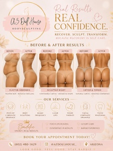 60-Min Targeted Lymphatic Massage with Radio Frequency for Detox & Toning + Free Belly Wrap - AZ Doll House 
