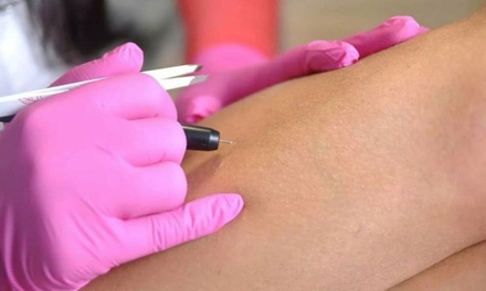 One 15-Minute Electrolysis Hair Removal Treatment - The Laser Queen MD Beauty Studio in Hallandale