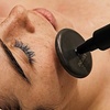 Image 10: 1, 2 o 4 sesiones de radiofrecuencia facial