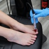 Image 1: Effective Toe Fungus Laser Treatment for up to 10 Toes! 