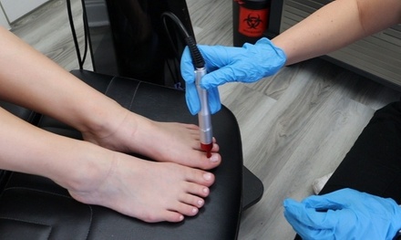One toenail fungus laser treatment for up to 10 toes - 26 Foot and Ankle of Watkinsville