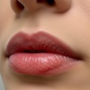 Image 3: Lip Laser Rejuvenation with/wihtout Hyaluronic Acid Filler Options