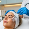Image 1: 60 min - Deluxe/Hydra Facial/Fusion Plasma or 35 min Carbon Peel