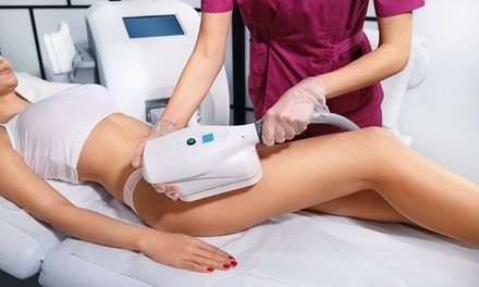 1 sesión de criolipolisis en una zona a elegir - Galatea Centro Médico Estético