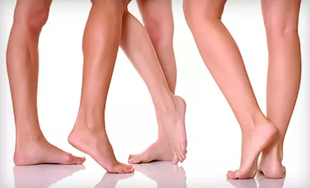 $99 for Consultation and a Sclerotherapy Treatment at Dekalb Vein Center (Up to $369 Value) - Primary Image