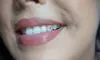 Shine Bright with Tooth Gems at Piercings by Marah (Up to 60% Off)