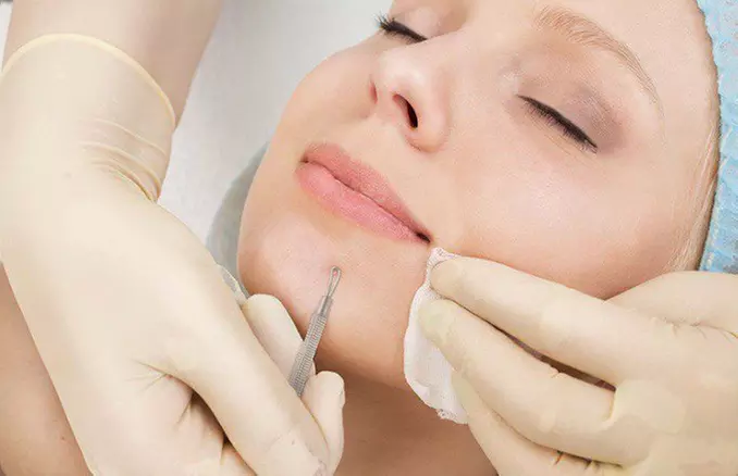 Wieloetapowe oczyszczanie twarzy z konsultacją kosmetologa