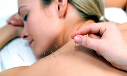 One 90-Minute Acupuncture Consultation and Session with One 60 Minute Follow Up - Dr Zhao Qi Huang Acupuncture And Wellness Clinic