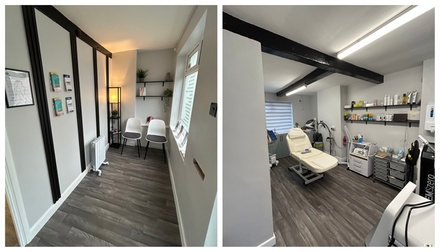 HIFU High Intensity Focused Ultrasound Lower face including Jowls - Soft Soles Nottingham