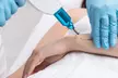 Laser Tattoo Removal with 1 or 3 Sessions for Small Medium or Large Areas @ Laser Therapy Clinic(Up To 74% Off) - Image 4