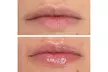 Pamper Me Pretty Day Spa Offers Hydrating Lip Drip Treatment with/without Color Boost (Up to 30% Off) - Second Medium