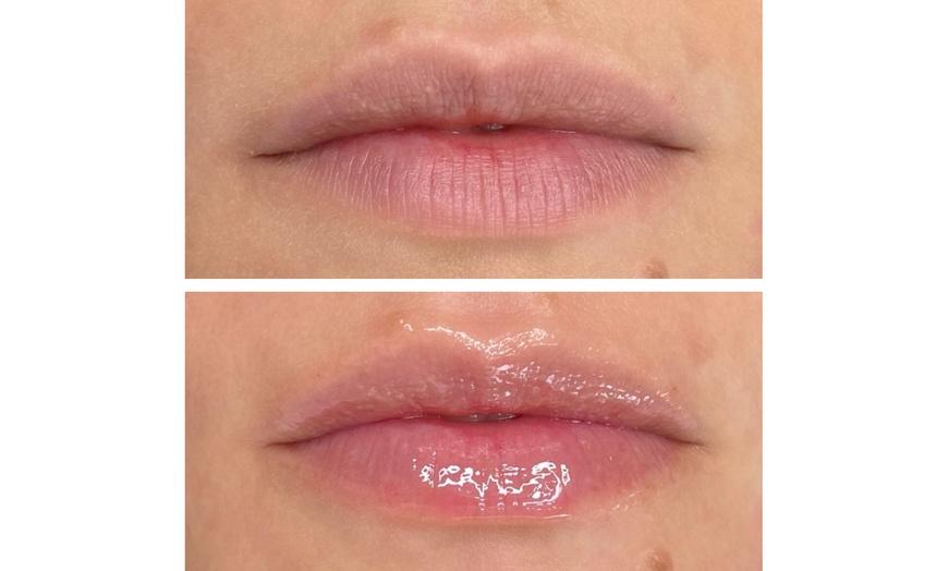 Image 3: Hydrating Lip Drip Treatment with/without Color Boost