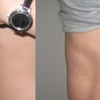 Image 4: Up to 73% Off on Ultrasonic Fat Reduction at LAMURE Aesthetic Clinic