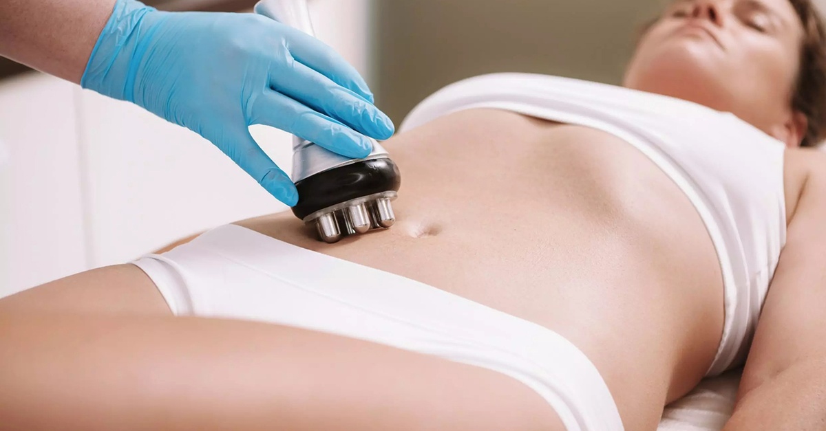 Tratamientos corporales de cavitación, radiofrecuencia y presoterapia en Madrid