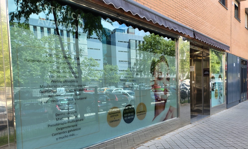 Image 8: Sesiones de cavitación, presoterapia o radiofrecuencia y drenaje